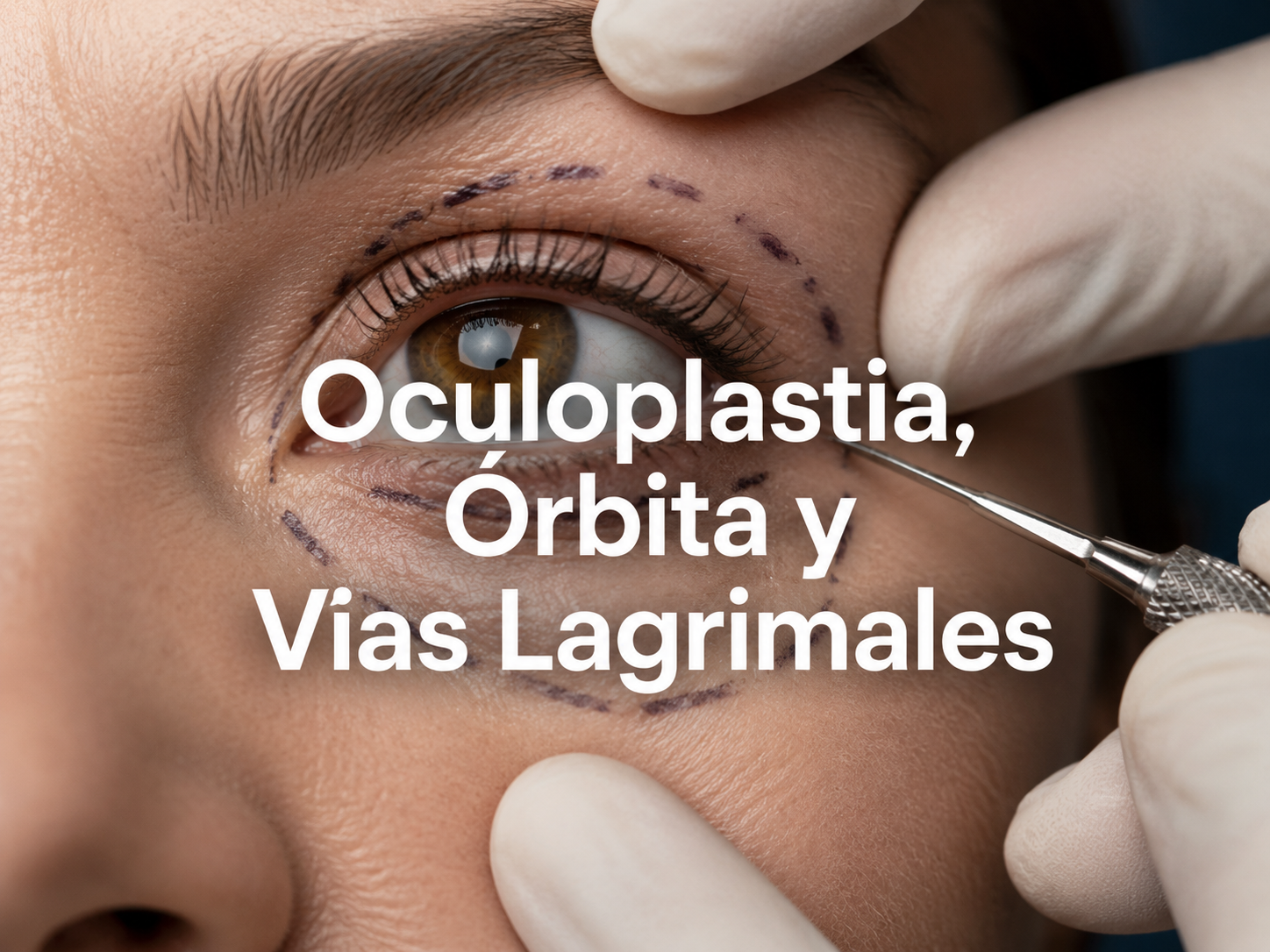 Oculoplastia, Órbita y Vías Lagrimales